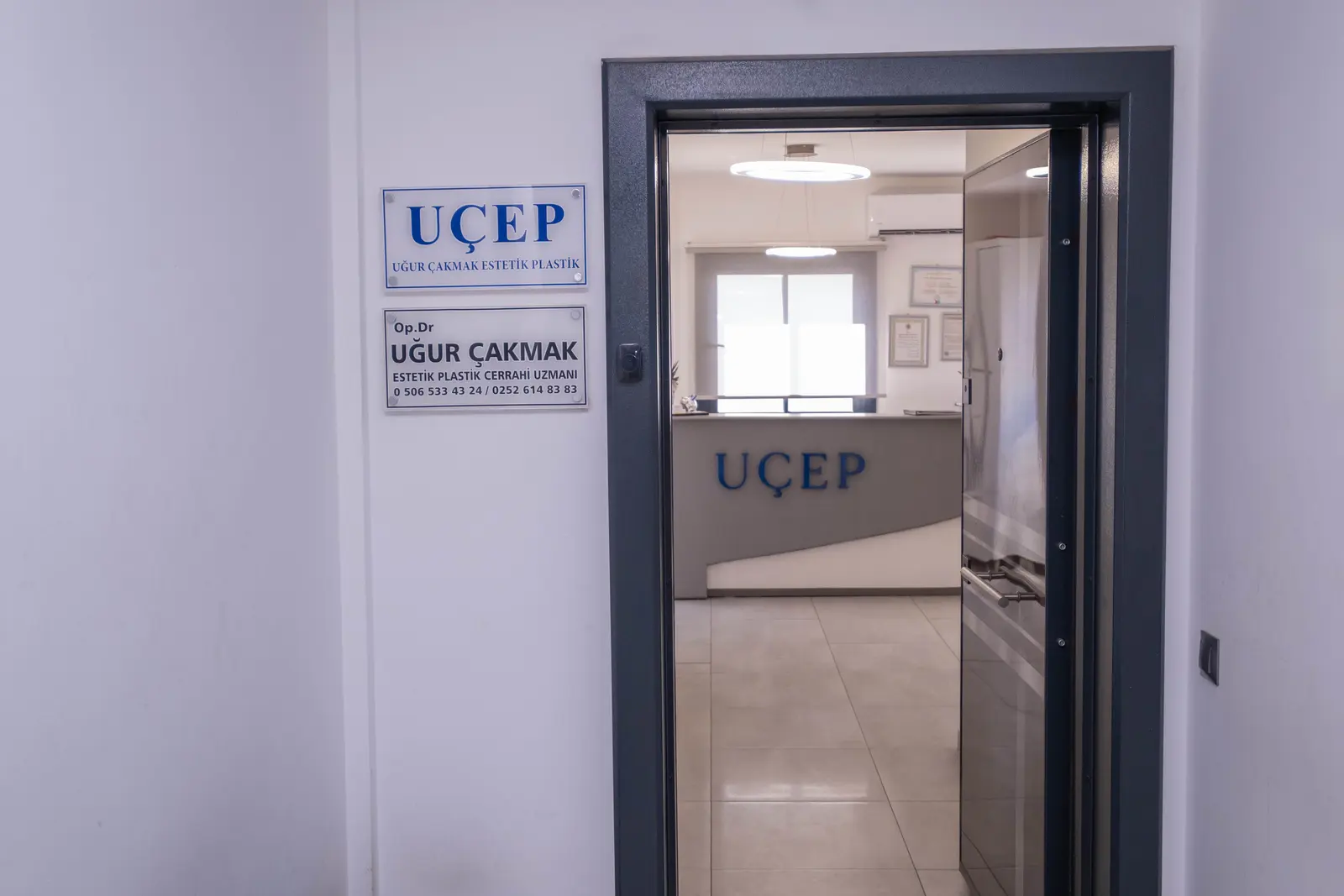 UÇEP